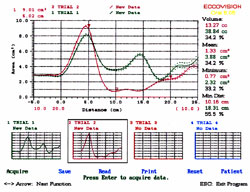 pharygraph